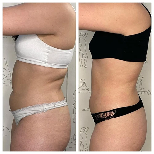 Makeover Treatment Snellville GA Before and After5 Makeover Treatment Snellville GA Before and After5